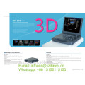 Ultrason d&#39;ordinateur portable de l&#39;équipement médical 3D et doppler de couleur